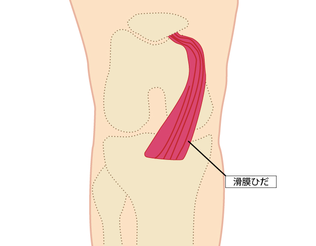 膝の痛み タナ障害 名古屋市昭和区金山の鍼灸院 松本治療院